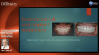 Economical and Simple Full Mouth Restorations Webinar Thumbnail
