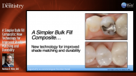 A Simpler Bulk Fill Composite: New Technology for Improved Shade Matching and Durability Webinar Thumbnail