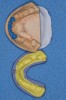 Figure 13  Initial matrix for mandibular rehabilitation. Anterior teeth may be provisionalized using the occlusal surfaces of the posterior teeth as stops.