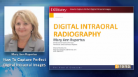How to Capture Perfect Digital Intraoral Images Webinar Thumbnail