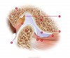 (1.) Lateral view of cross-section through the TMJ: [1] Posterior slope of the eminentia; [2] condyle; [3] disc; [4] superior lateral pterygoid muscle; [5] inferior lateral pterygoid muscle; [6] synovial tissue; [7] retrodiscal
tissue; [8] posterior ligamentous attachment of disc to condyle.