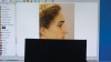 (7.) Demonstration that the upper face and upper lip appear to be quite normal in isolation and that her profile convexity was due to the moderate deficiency of the mandible and, in larger part, the chin.