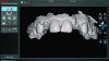 Fig 2. True Definition Scanner (3M ESPE) scan of encode abutments.
