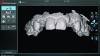 Fig 2. True Definition Scanner (3M ESPE) scan of encode abutments.