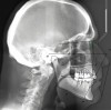 (3.) Pretreatment cephalometric analysis.