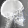 (5.) Postorthodontic cephalometric analysis.