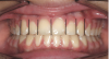 Figure 2   A balanced appearance of the anterior teeth is represented by a 