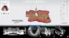 (30.) Virtual tooth setup and projected implant position.