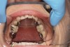 (3.) Small mandible with lingualized teeth.