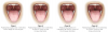 (3.) Pharyngeal grading system.