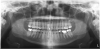(2.) Panoramic radiographs are options when intraoral radiography is impractical or additional diagnostic information is required.