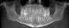 (1.) CBCT panoramic view.