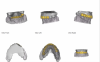 Fig 3. Intraoral scanning documents a patient’s smile from various views.