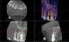 (7.) Pretreatment CBCT scan.