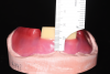 (3.) Mandibular wax rim on a pink cast with yellow speaking wax and a ruler measuring 18 mm from the base of the vestibule to the anticipated incisal edge position.