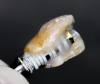 (51.) Palatal view of the partially completed natural tooth provisional restoration after it was removed from the mouth.