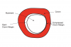 (4.) Horizontal sectional view at the crown margin level, showing how compression can result in malpositioning of the crown and an open margin.