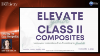 Elevating Your Class II Composites Webinar Thumbnail