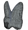 (7.) A 3D image of the mesial aspect of a maxillary first molar with the challenging concave region leading to the furcation shaded.