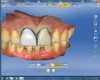 Figure 16 The initial proposal provided acceptable designs, but the width, incisal edge position, and basic outline form did not match.