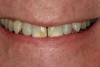 Figure 1  Preoperative smile.