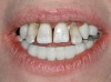 Figure 1  Compare and Contrast, Pre-extraction dentate state.
