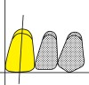 Figure 18  The maxillary central incisor is placed so that the long axis shows a slight distal inclination to the perpendicular.