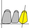 Figure 22  Schematics (22.) The long axis of the maxillary canine also has a slight distal inclination. (23.) The neck of the maxillary canine is prominent. (24.) The incisal guidance angle is formed by a line drawn through the incisal edges of the maxillary and mandibular incisors and the horizontal plane. (25.) Mesio-distal inclinations of the mandibular anterior teeth and incisal position after adjustment to maintain 