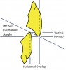 Figure 24  Schematics (24.) The incisal guidance angle is formed by a line drawn through the incisal edges of the maxillary and mandibular incisors and the horizontal plane.