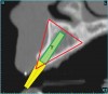 Figure 7  SOFTWARE IMAGING The determination of the 