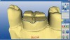 Figure  15  TECHNIQUE Digital scan of the buccal view.