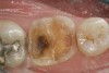 Figure 22   Occlusal view of the finished preparation.