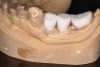 Figure 3  Barium-containing radiographic template.