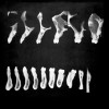 Figure 6  Tomograms showing natural teeth alignments on their bony bases (from Wheeler’s Dental Anatomy, Physiology, and Occlusion Textbook).