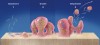 Figure 1  The biofilm life cycle in three steps: attachment, growth of colonies, and detachment in clumps. (Adapted from Peters LB. Desinfectie van het wortelkanallstelsel bij de endodontishche behandeling. Ned Tijdschr Tandheelkd. 2005;112:461-512(p468). Used with permission from Montana State University Center for Biofilm Engineering.)